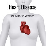 Cardiovascular Disease Affects Nearly Half of U.S. Adults